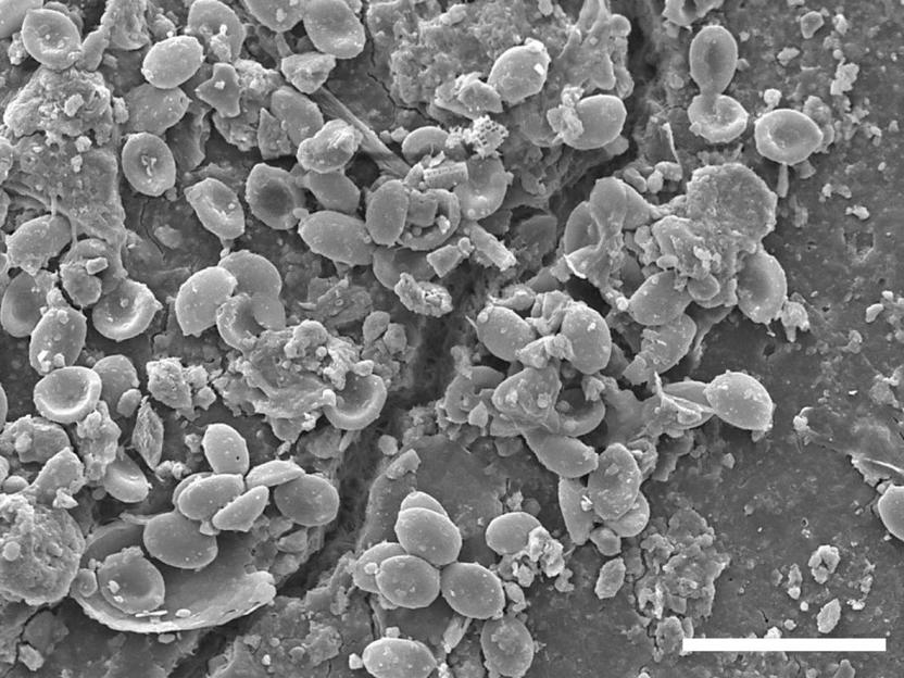 Mikroplastik in Böden wird von krankheitserregenden Pilzen besiedelt - Vimarsana News